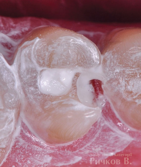 clinical_case_mal_2.jpg