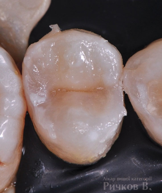 clinical_case_mal_3-1-.jpg