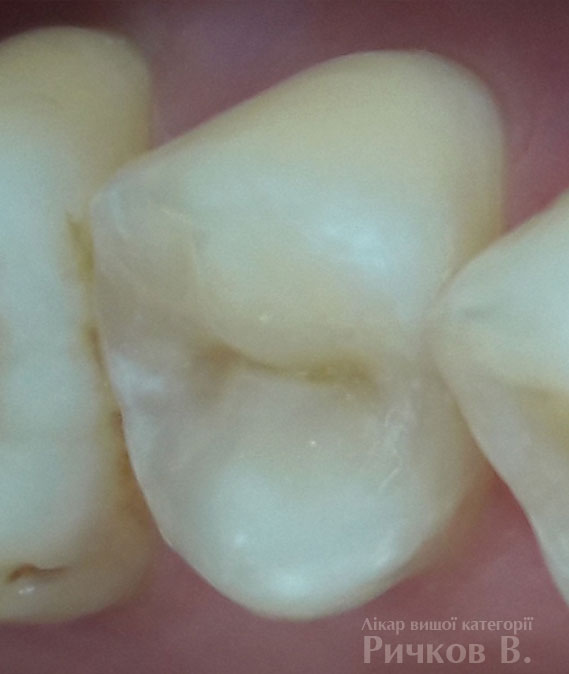 clinical_case_mal_7.jpg
