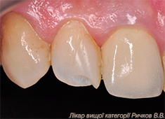 clinical_case_1.jpg