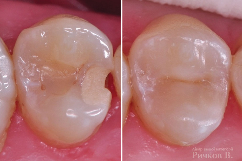 clinical_case_mal_8.jpg
