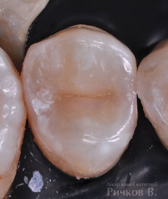 clinical_case_mal_3-2.jpg