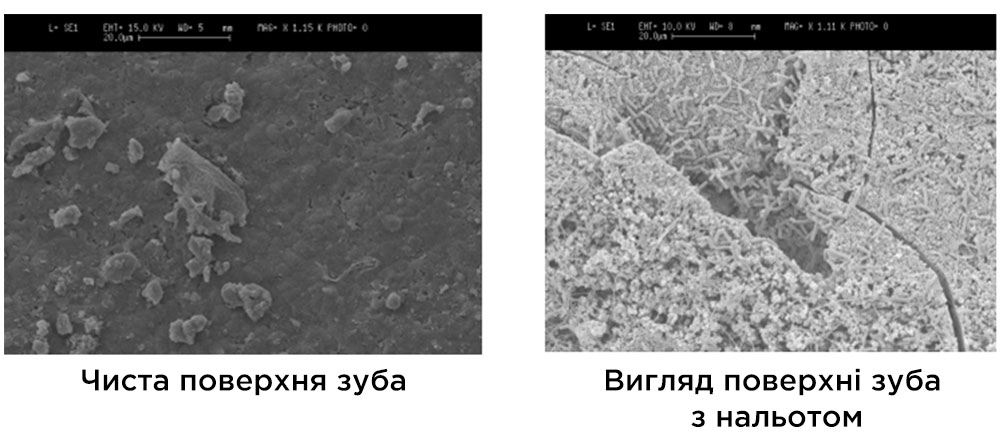 DENTAID, article, biofilm dental DENTAID, article, biofilm dental
