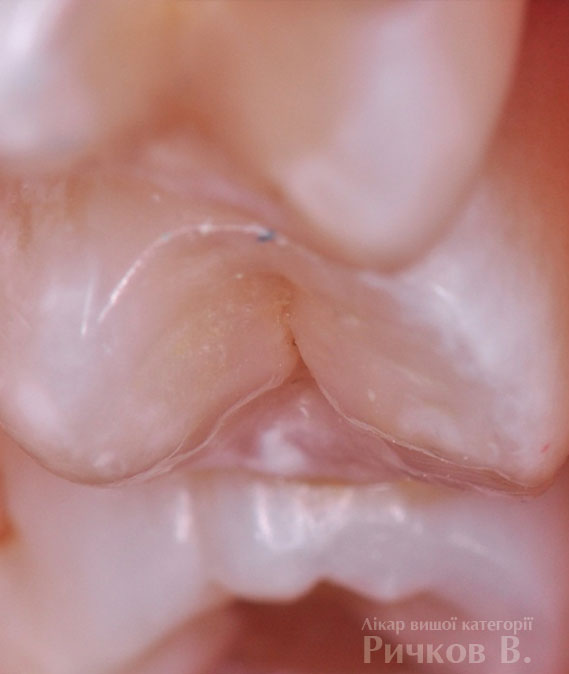clinical_case_mal_6.jpg