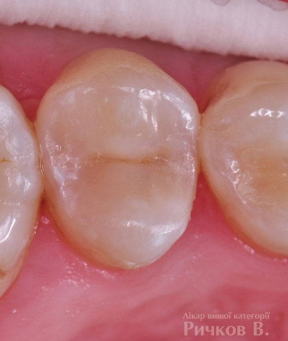 clinical_case_mal_5.jpg