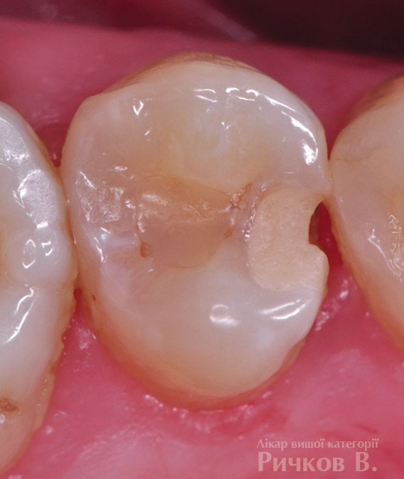 clinical_case_mal_1.jpg