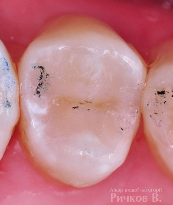 clinical_case_mal_4.jpg