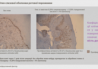 DENTAID TECHNOLOGY HYALURONREPAIR